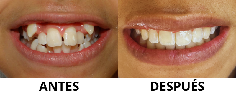 testimonios (2)